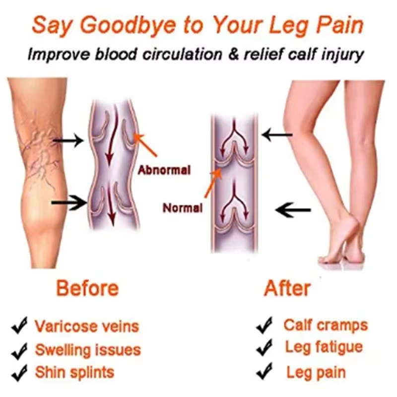 ถุงเท้ารัดกล้ามเนื้อสำหรับผู้ห - Compression Sleeve Calf บทวิจารณ์และราคา